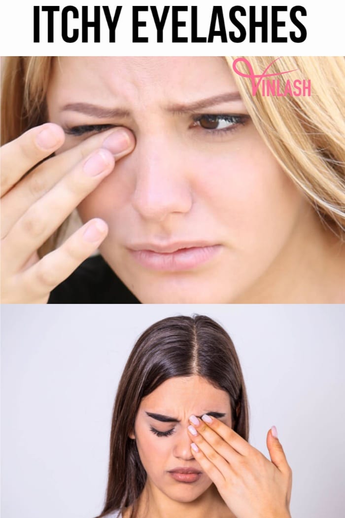 How to Address eyelash extensions itchy