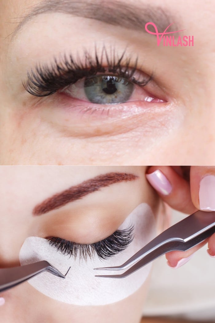 Best Tip To Avoid Allergic Reactions To Eyelash Extensions