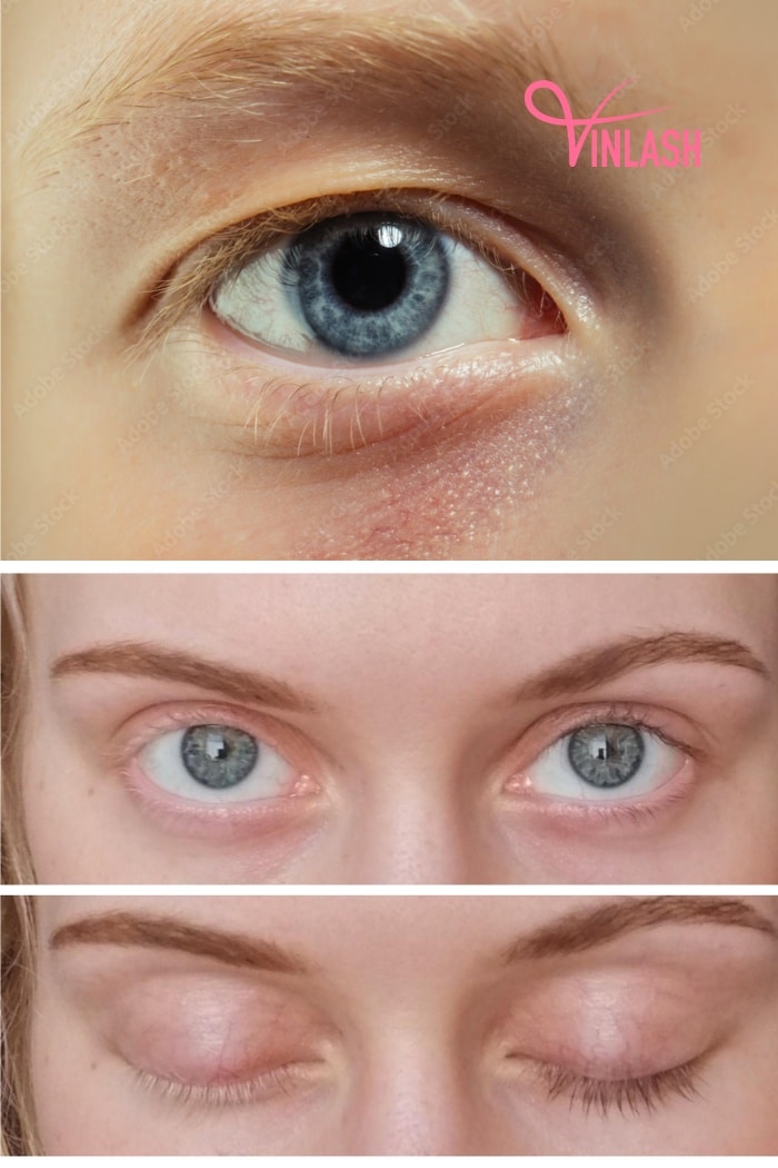 eyelash-extensions-on-blonde-eyelashes-1