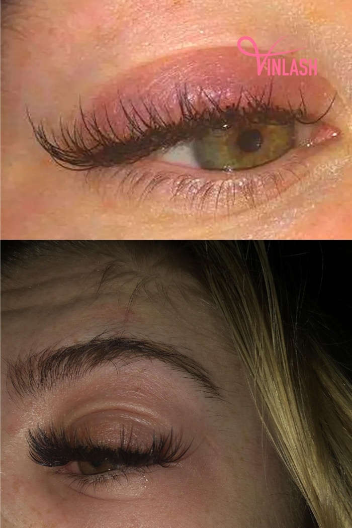 Allergic Reactions Issue